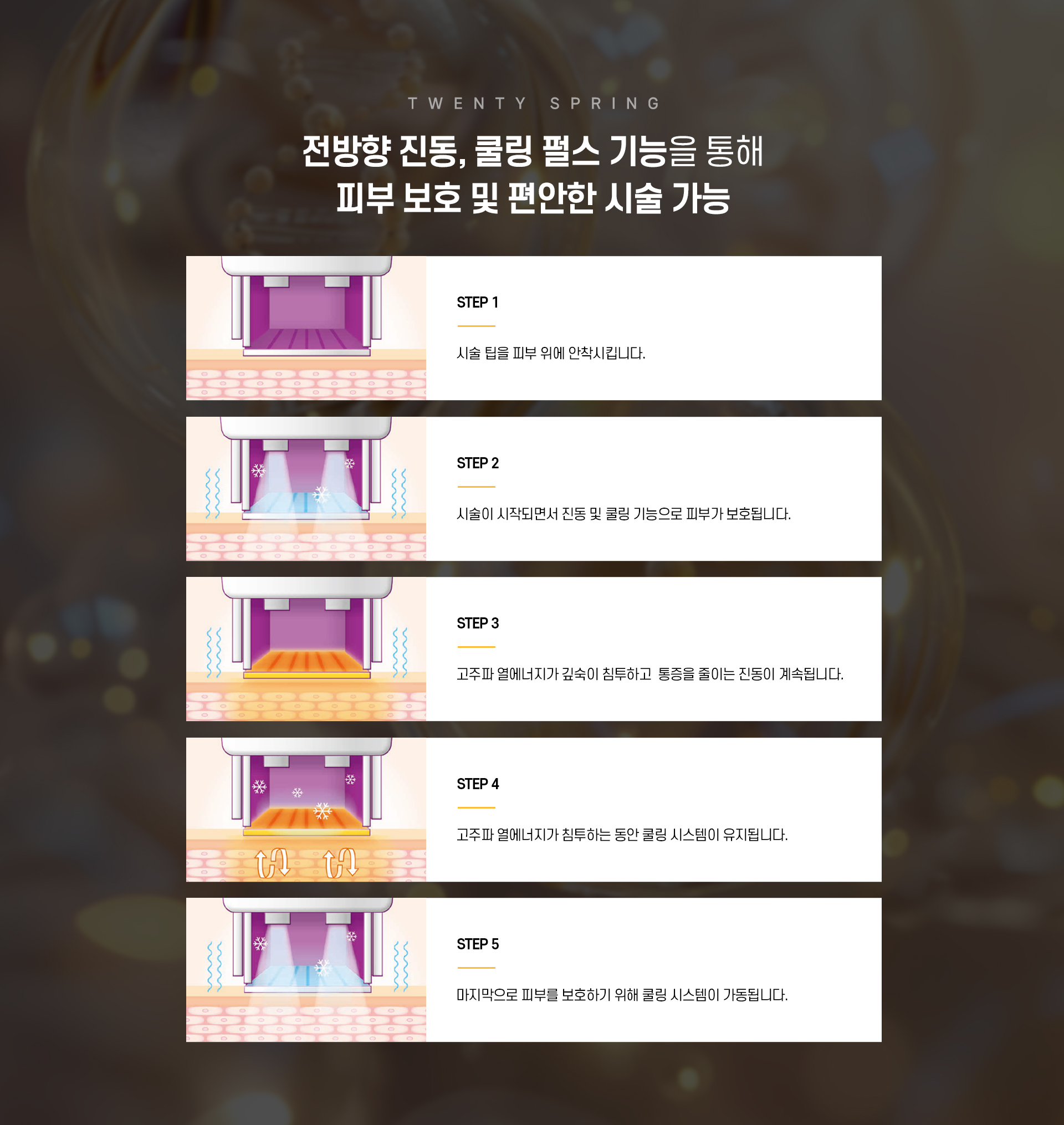 써마지_05