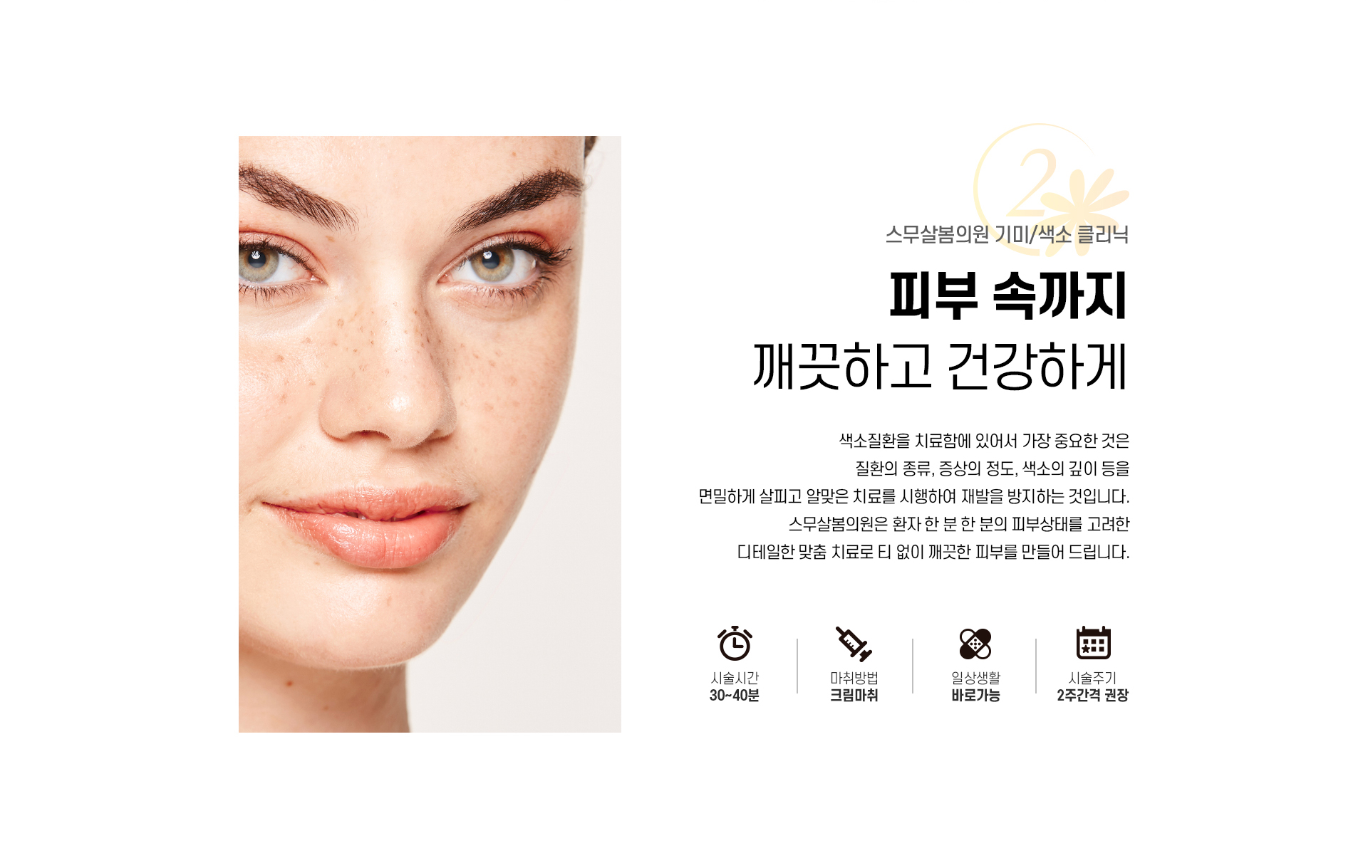 기미/색소 치료_02