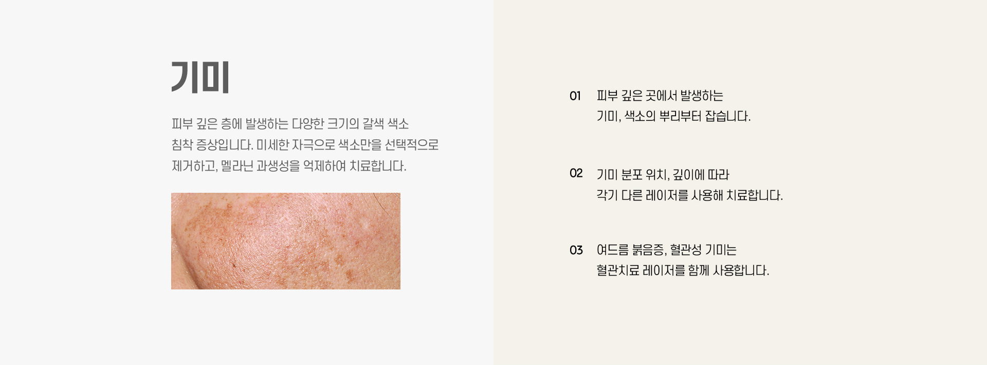 기미