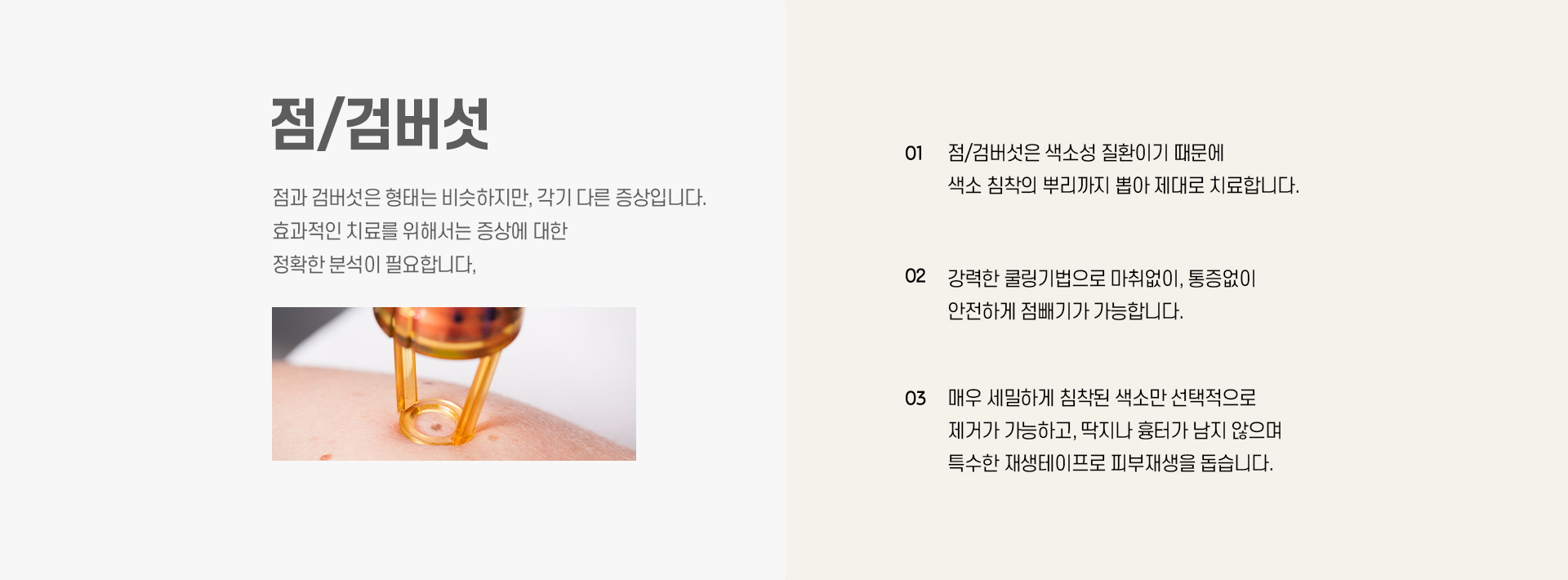 점/검버섯