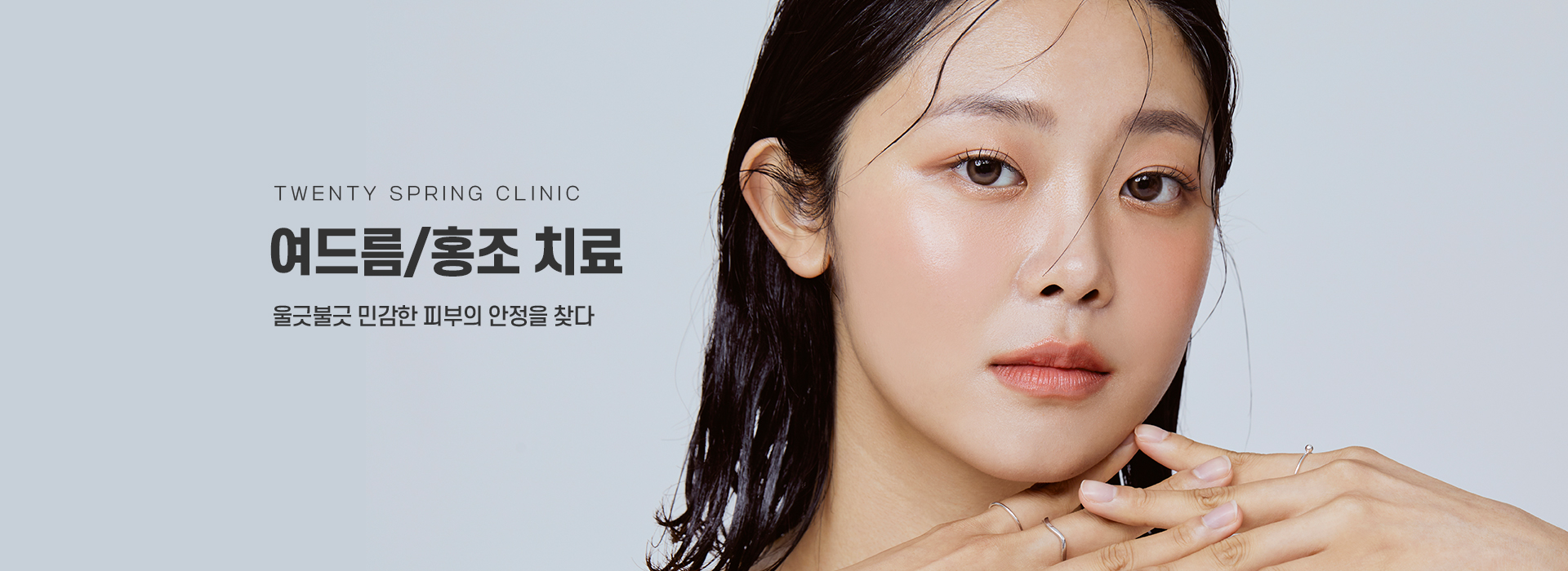 여드름/홍조 치료_01_키비주얼