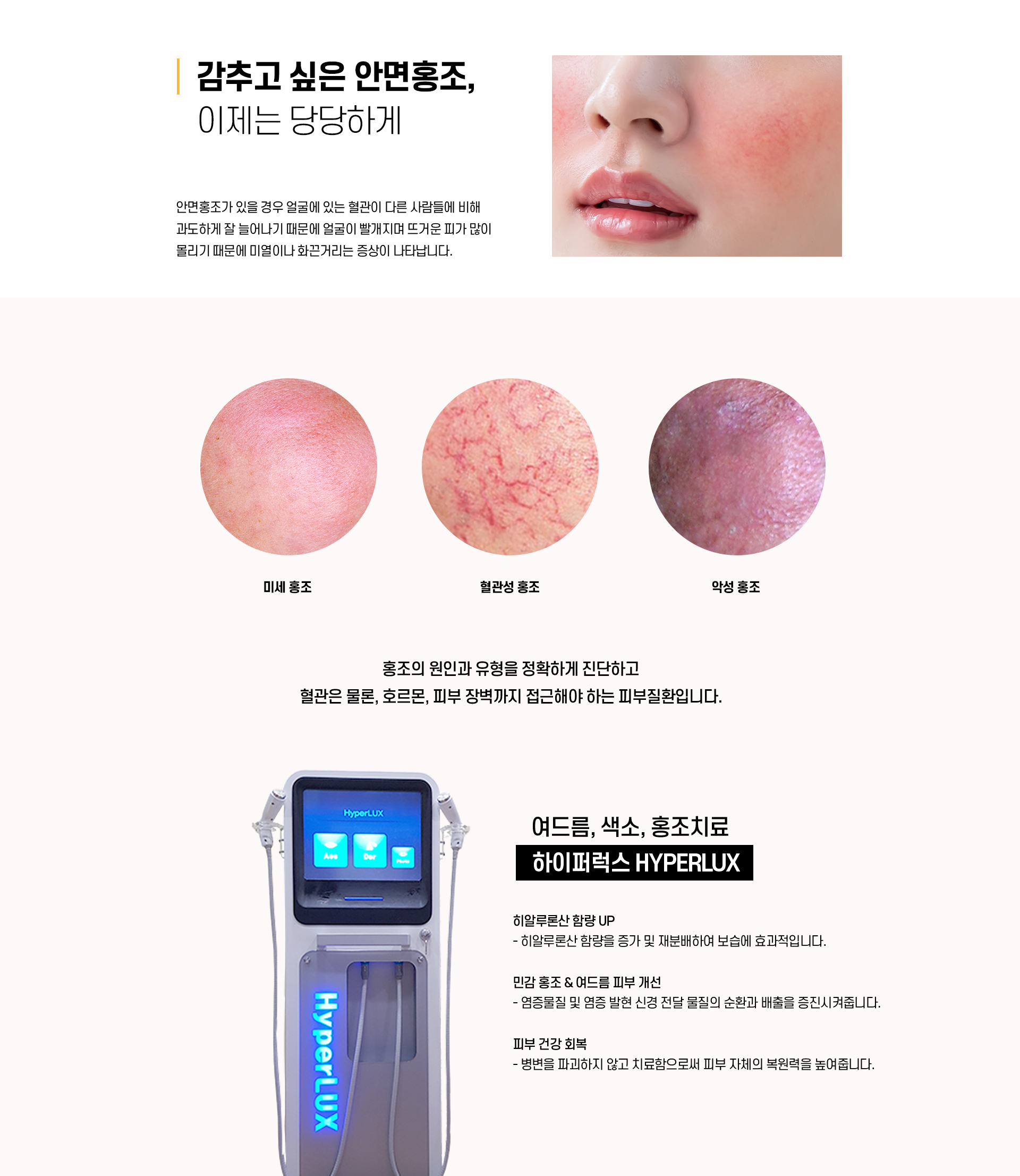 홍조