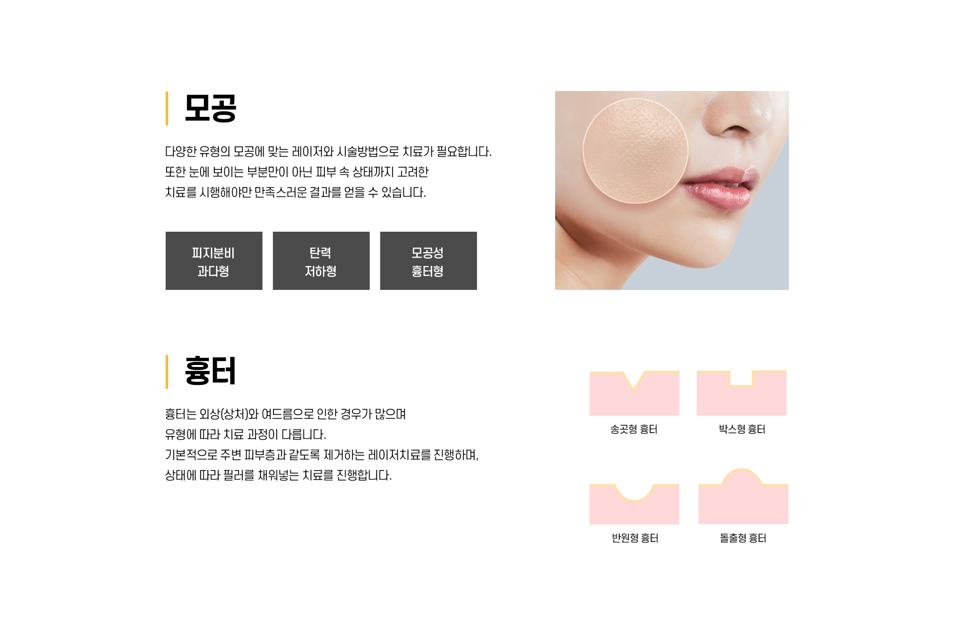 흉터/모공 치료_03